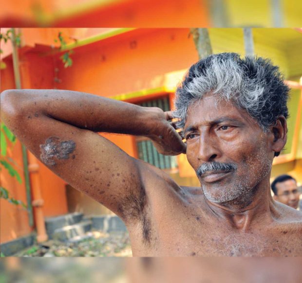 Effects of Arsenic