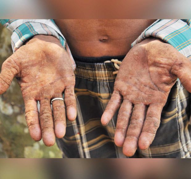 Effects of Arsenic 4